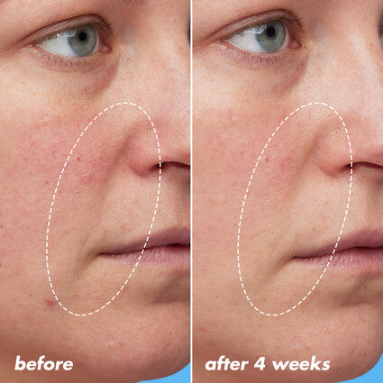 Blue-ty Sleep Night Oil